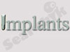 implants.co.il פורטל השתלות השיניים 
